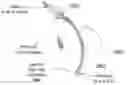 Fig. 01 - METHOD AND APPARATUS FOR BLOCKING FLUID FLOW IN AN INTUBATED TRACHEA