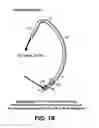 Fig. 03 - METHOD AND APPARATUS FOR BLOCKING FLUID FLOW IN AN INTUBATED TRACHEA