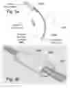 Fig. 07 - METHOD AND APPARATUS FOR BLOCKING FLUID FLOW IN AN INTUBATED TRACHEA