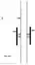 Fig. 30 - METHOD AND APPARATUS FOR BLOCKING FLUID FLOW IN AN INTUBATED TRACHEA