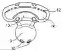 Fig. 01 - Anti-snoring device