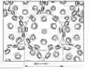 Fig. 01 - Method for forming an interventional aid with the aid of self-organizing nanorobots consisting of catoms and associated system unit