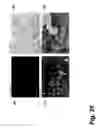 Fig. 33 - Amorphous alloy materials