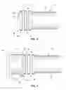 Fig. 05 - Expansion repair coupling