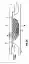 Fig. 03 - APPARATUS AND METHOD FOR TRAPPING BEAD BASED REAGENTS WITHIN MICROFLUIDIC ANALYSIS SYSTEMS