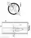 Fig. 09 - Apparatus to separate light fluids, heavy fluids, and/or sediment from a fluid stream