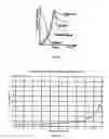 Fig. 04 - Insertion-point seal for spiral wound module