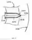 Fig. 24 - Method and device for extraction of liquids from a solid particle material