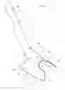 Fig. 02 - Hosiery donning device, in particular for compression hosiery