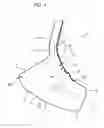 Fig. 05 - Hosiery donning device, in particular for compression hosiery
