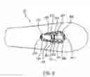 Fig. 09 - Removable spread head