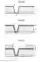 Fig. 07 - SEMICONDUCTOR DEVICE AND METHOD OF MANUFACTURING THE SEMICONDUCTOR DEVICE