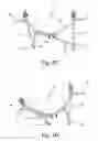 Fig. 07 - Field litter carrier