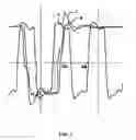 Fig. 04 - Oscillograph and signal identifying method of a serial data bus using the oscillograph
