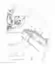 Fig. 02 - RF coil for MR imaging which is not visible in X-ray image