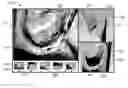 Fig. 01 - Synchronized views of video data and three-dimensional model data
