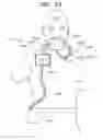 Fig. 100 - Biologically fit wearable electronics apparatus and methods