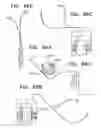 Fig. 136 - Biologically fit wearable electronics apparatus and methods