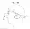Fig. 199 - Biologically fit wearable electronics apparatus and methods