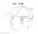 Fig. 233 - Biologically fit wearable electronics apparatus and methods