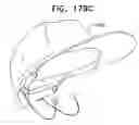 Fig. 243 - Biologically fit wearable electronics apparatus and methods