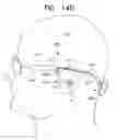 Fig. 26 - Biologically fit wearable electronics apparatus and methods
