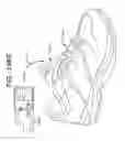 Fig. 285 - Biologically fit wearable electronics apparatus and methods