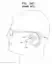 Fig. 53 - Biologically fit wearable electronics apparatus and methods