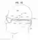 Fig. 67 - Biologically fit wearable electronics apparatus and methods