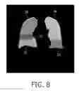 Fig. 06 - Apparatus for segmenting an object comprising sub-objects
