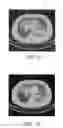 Fig. 07 - Apparatus for segmenting an object comprising sub-objects