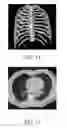 Fig. 08 - Apparatus for segmenting an object comprising sub-objects