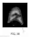 Fig. 12 - Apparatus for segmenting an object comprising sub-objects