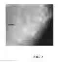 Fig. 02 - SYSTEM FOR IMAGING PATHWAY VERIFICATION