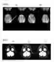 Fig. 06 - Method and magnetic resonance system to correct distortions in image data