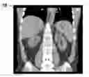 Fig. 01 - COMPOSITE IMAGES FOR MEDICAL PROCEDURES
