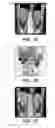 Fig. 02 - COMPOSITE IMAGES FOR MEDICAL PROCEDURES