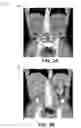 Fig. 03 - COMPOSITE IMAGES FOR MEDICAL PROCEDURES