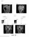 Fig. 13 - COMPOSITE IMAGES FOR MEDICAL PROCEDURES