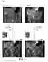 Fig. 14 - COMPOSITE IMAGES FOR MEDICAL PROCEDURES