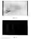 Fig. 05 - BIODEGRADABLE CONTRAST AGENTS