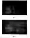 Fig. 06 - BIODEGRADABLE CONTRAST AGENTS