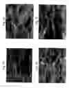 Fig. 02 - Implants for administering substances and methods of producing implants