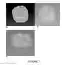Fig. 07 - CERAMIC SCAFFOLDS FOR BONE REPAIR