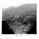 Fig. 07 - Haemostatic material