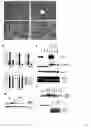 Fig. 02 - Methods for modulating de novo hepatic lipogenesis by modulating XBP-1 activity