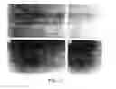 Fig. 02 - IDENTIFICATION OF A PLURIPOTENT PRE-MESENCHYMAL, PRE-HEMATOPOIETIC PROGENITOR CELL