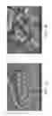 Fig. 04 - Zinc Oxide and Cobalt Oxide Nanostructures and Methods of Making Thereof
