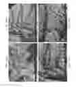 Fig. 41 - Zinc Oxide and Cobalt Oxide Nanostructures and Methods of Making Thereof