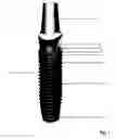 Fig. 02 - Dental implant